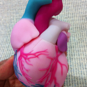3D Printed Heart Model - Full 2